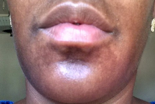 Before Face Concealer